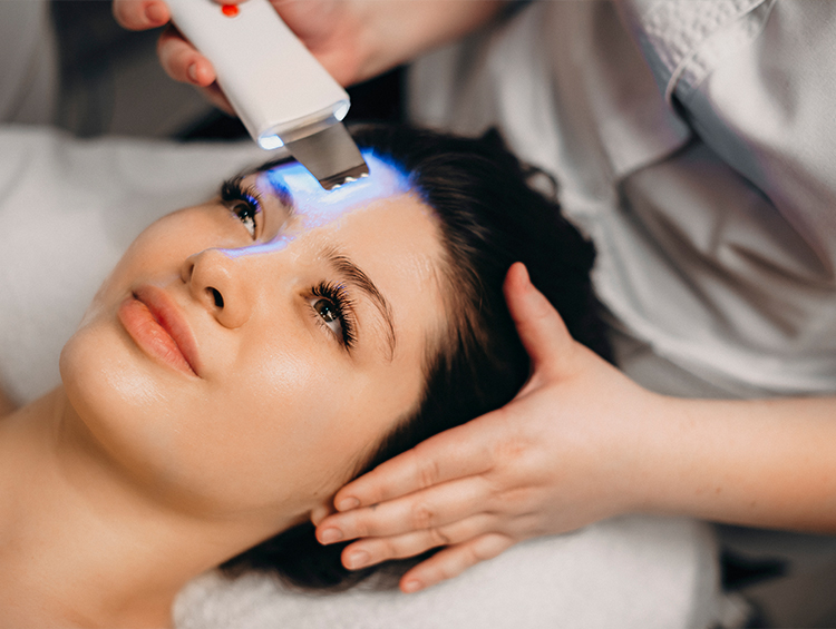 Acne Laser Treatment