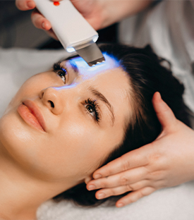 Acne Laser